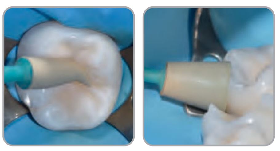 Thumbnail for Intensiv Unigloss Polisher Trial Kit