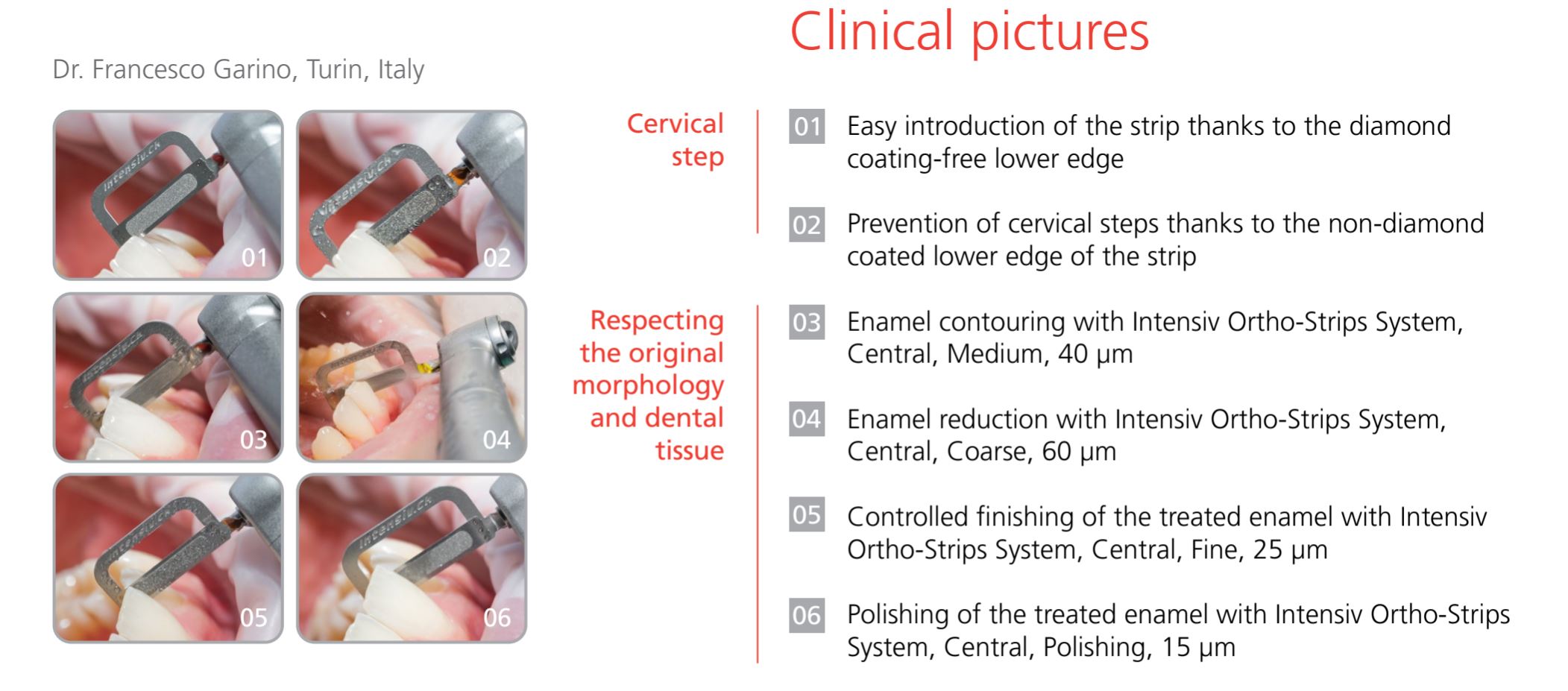 Thumbnail for Intensiv Ortho strip Central Double Sides Coated