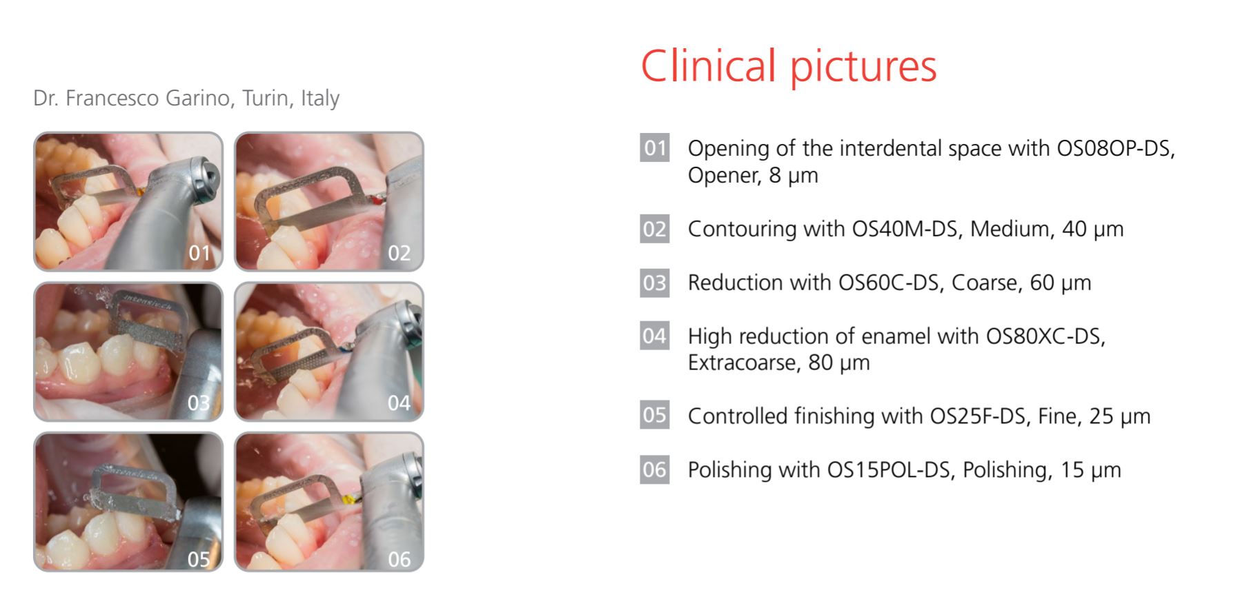 Thumbnail for Intensiv Ortho Strip Opener Left Side Coated