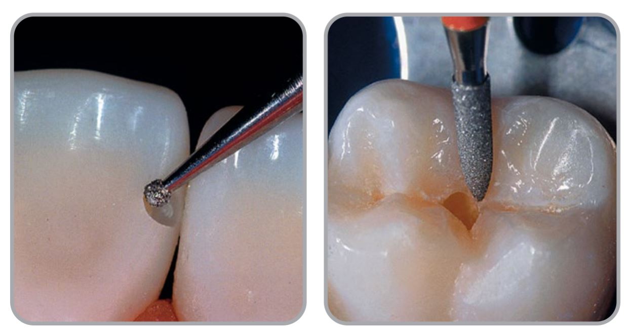 Thumbnail for Intensiv Combi Prep Set