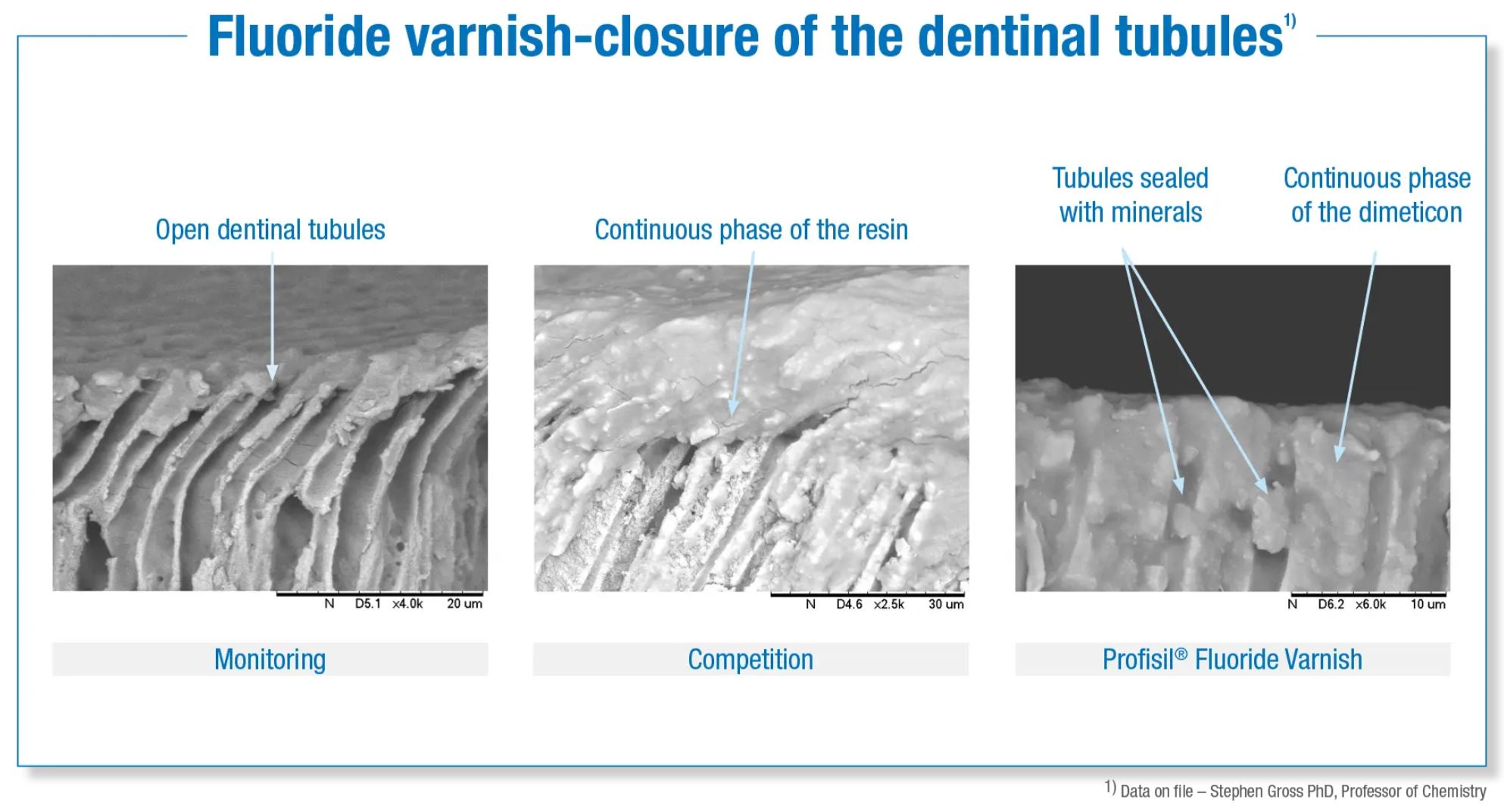 Thumbnail for Profisil Floride Varnish Combi Pack 