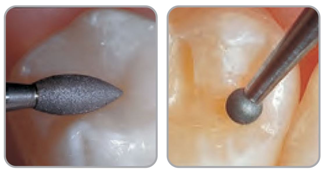 Thumbnail for Intensiv Composhape Set 1