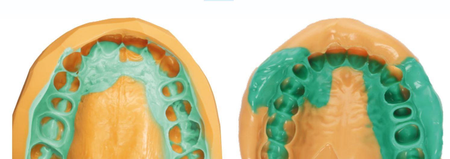 Thumbnail for Panasil Initial Contact X-Light Fast Normal Paack