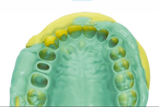 Thumbnail for Panasil Initial Contact Light Fast Normal Pack