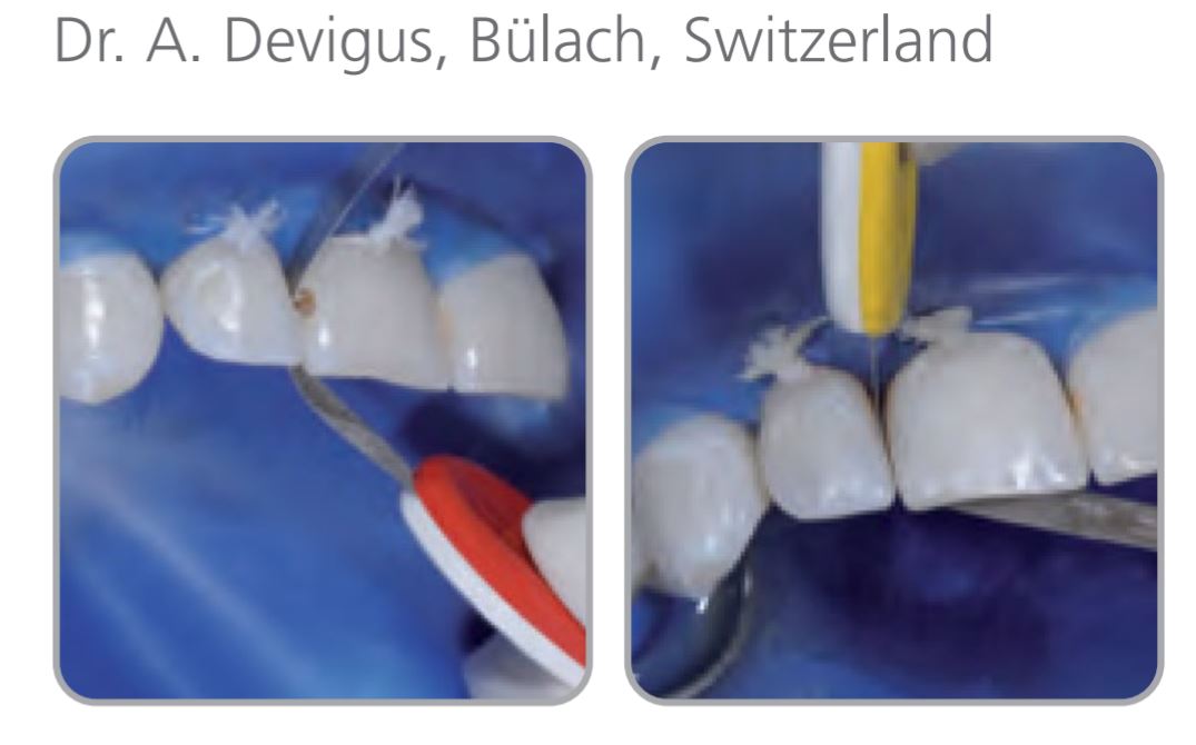 Thumbnail for Intensiv Proxo Strip Plus